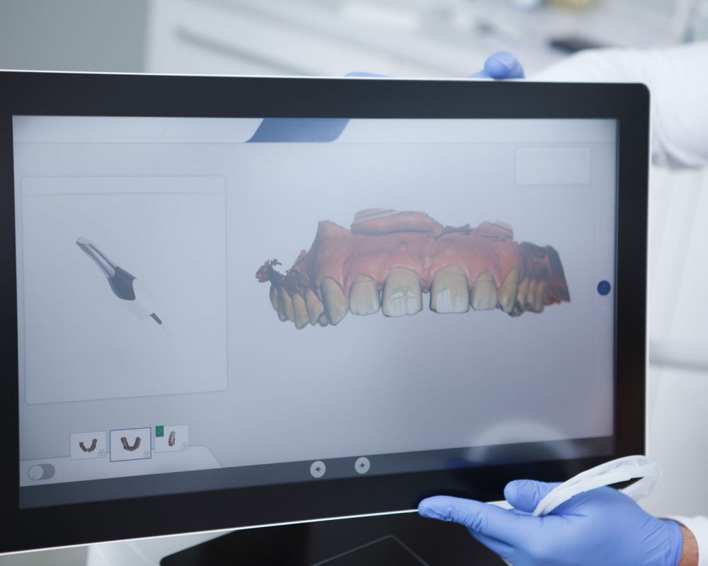 Dentist using intraoral scanner at work